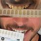 WOW Whites ultimate teeth whitening kit